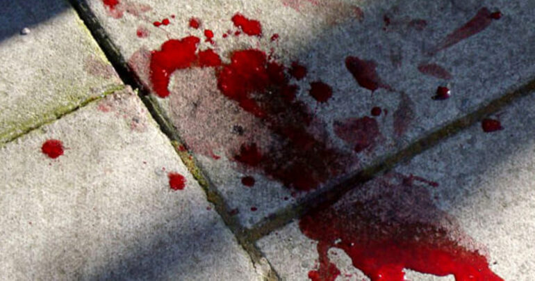 Lite con sparatoria in pizzeria a Gragnano: ferito 24enne di Sorrento