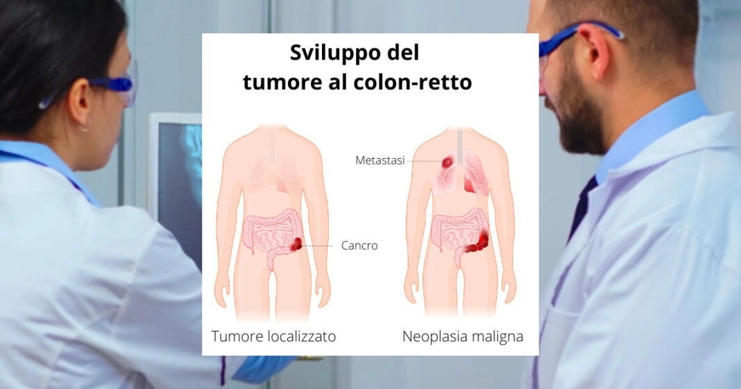 Giornata Mondiale della salute Tumore metastatico del colon-retto