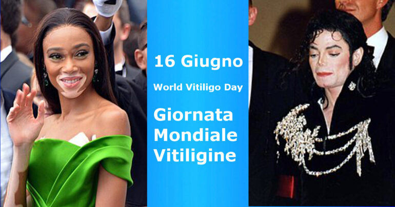 Vitiligine: 25 giugno; giornata del World Vitiligo Day