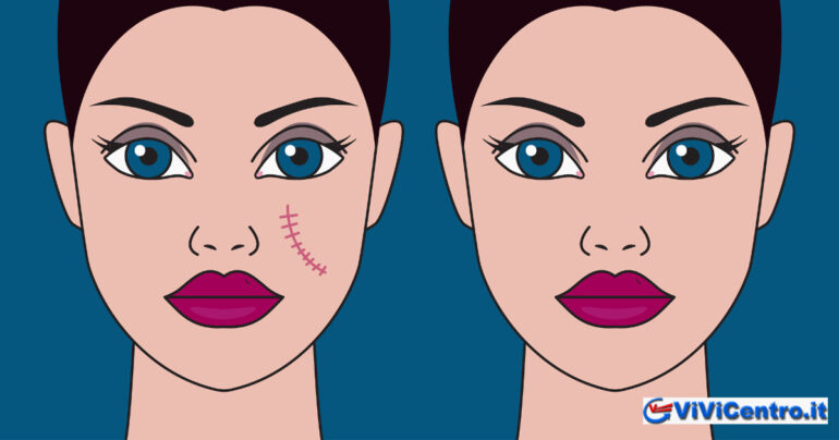 12enne sfregiata! La difesa: non voleva uccidere! Bene! Gli diamo un premio?