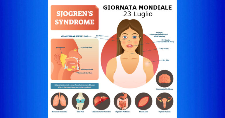 Giornata Mondiale della Sindrome di Sjögren: 23 Luglio 2022