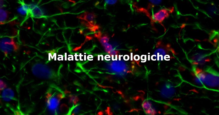 Malattie neurologiche: rilevato un incremento delle patologie