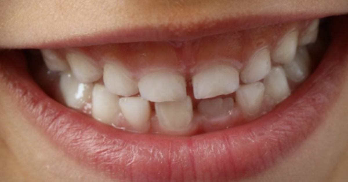 Farmaco rivoluzionario fa ricrescere i denti