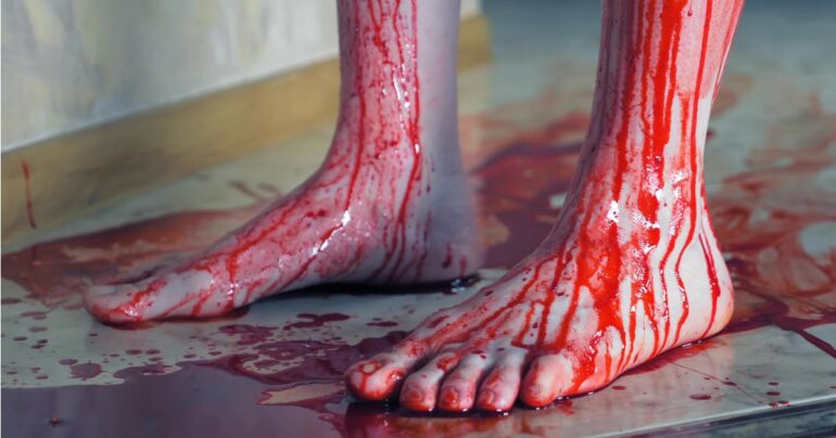 Tentato Omicidio Napoli: Giovane di 17 Anni Coinvolto