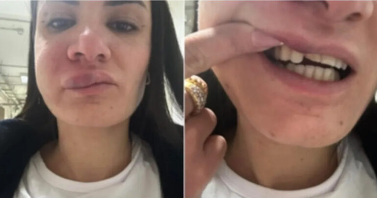 Violenza contro Infermiera Castellammare: Giudizio Immediato