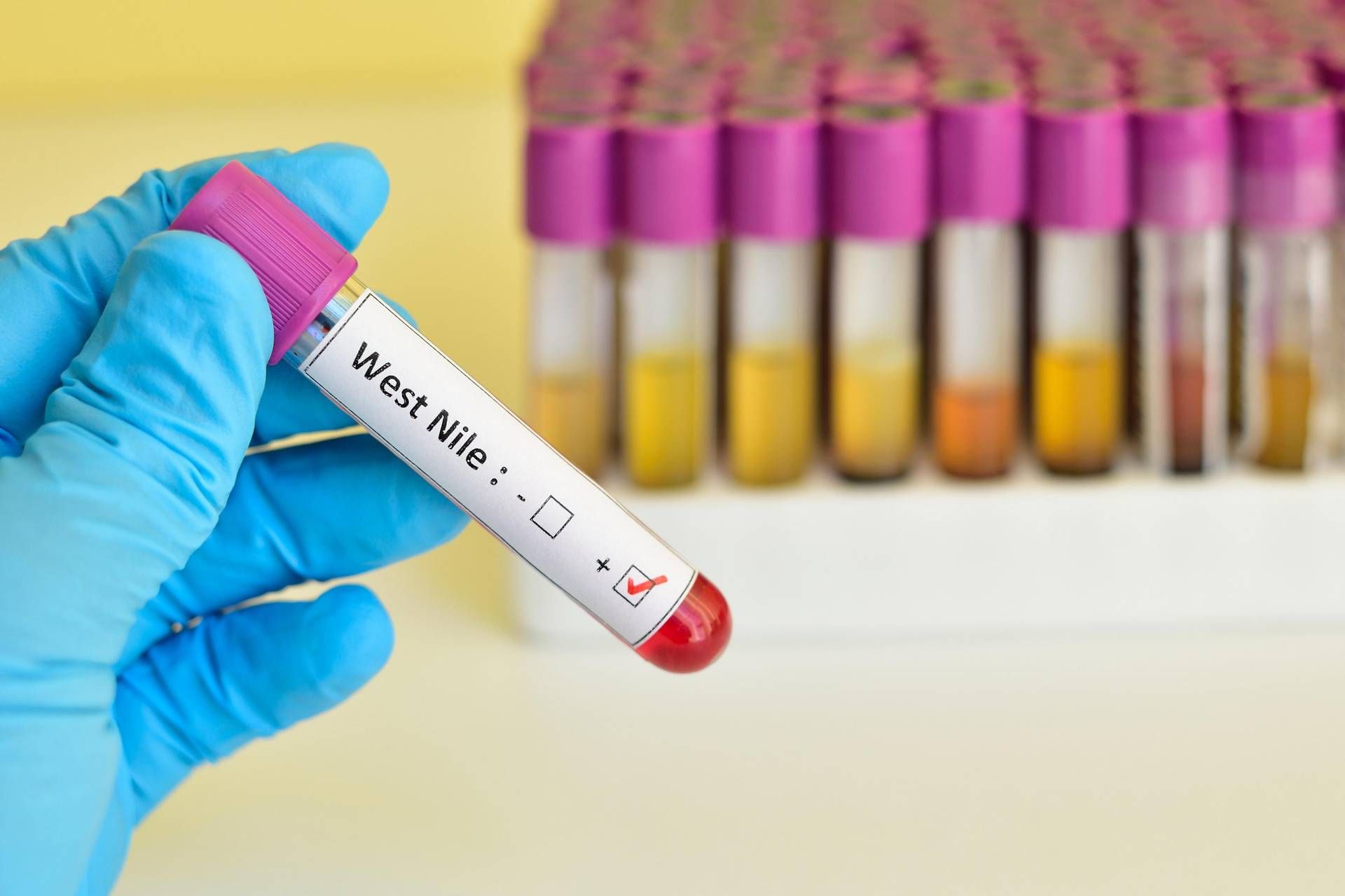 West Nile, altra vittima in Campania: età, ultime notizie