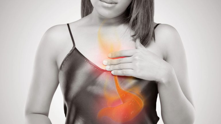 Patofisiologia clinica della malattia da reflusso gastroesofageo